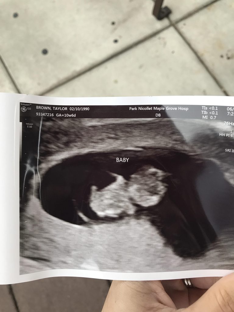 9 week ultrasound, blogger baby annoucement, the styled press, we're having a baby