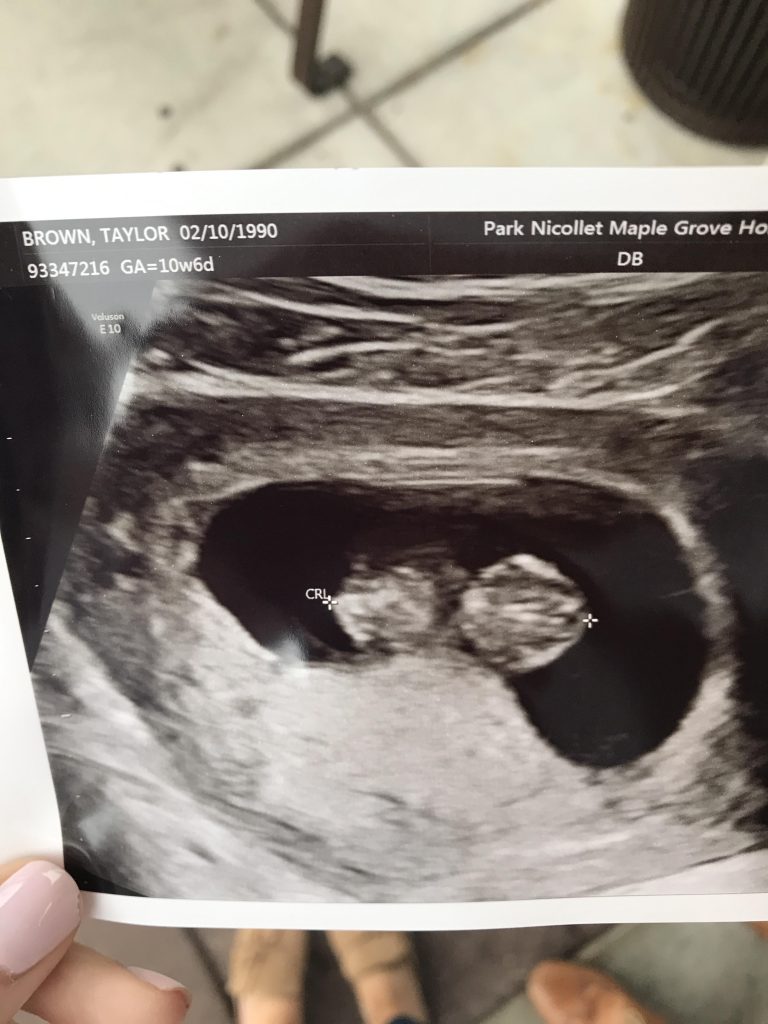 9 week ultrasound, blogger baby annoucement, the styled press, we're having a baby